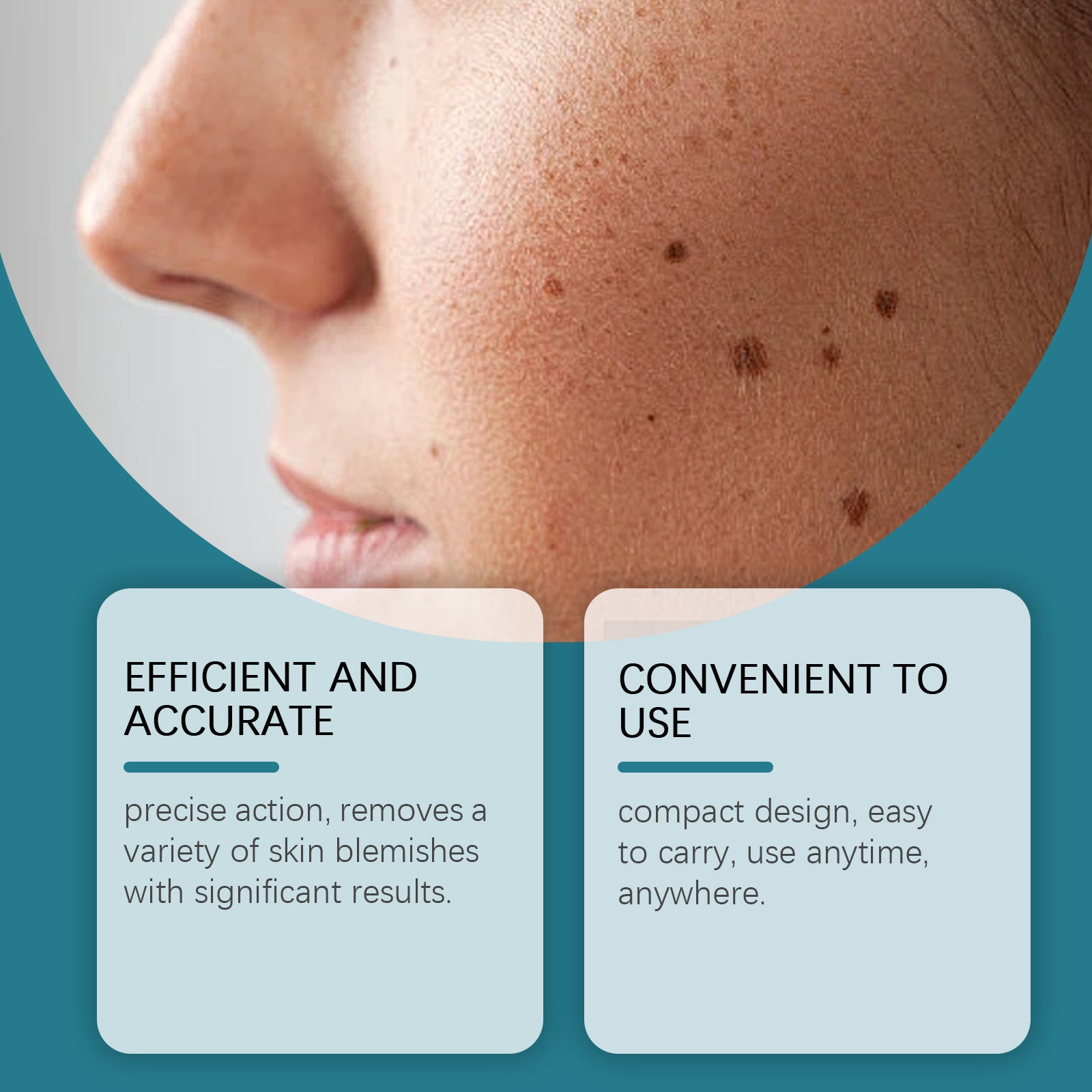 Skin Care Laser Pen - patrickkarten